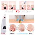 Blackhead Remover - TulipQueen
